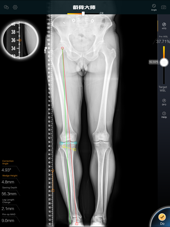 Screenshot #4 pour 截骨大师