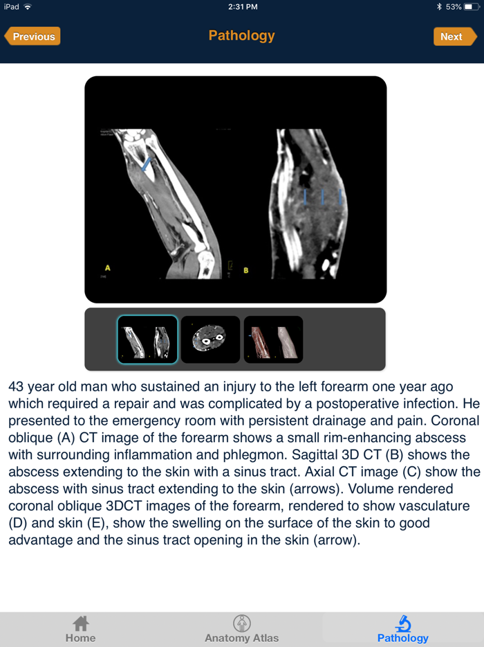CTisus CT of the Hand and Wrist