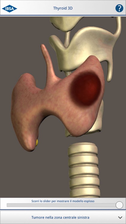 Thyroid 3D