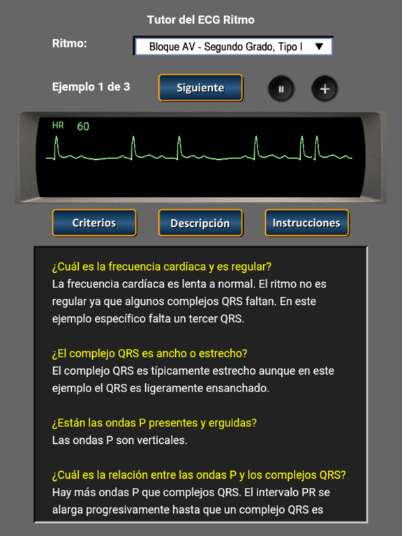 Screenshot #5 pour Tutor del ECG Ritmo