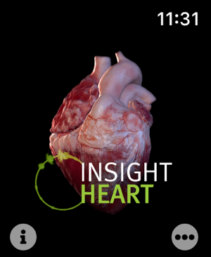 ‎INSIGHT HEART Skjermbilde