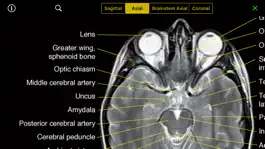 Game screenshot NeuroRad Mini hack