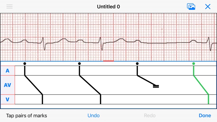 EP Diagram