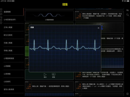 ECG Pro for Doctorsのおすすめ画像9