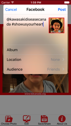 Kawasaki Disease Canada Photo Editor(圖3)-速報App