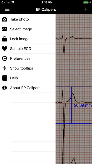 EP Calipers Screenshot