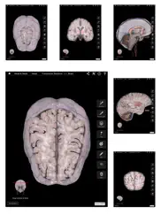 brain & nervous system pro iii айпад изображения 2