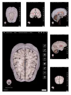 Brain & Nervous System Pro III iPad image 2