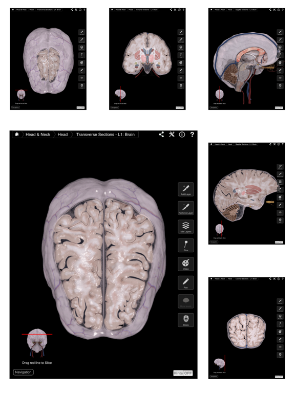 Screenshot #5 pour Brain & Nervous System Pro III