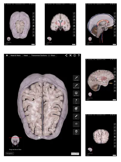 Brain & Nervous System Pro III iPhone Screenshot 2