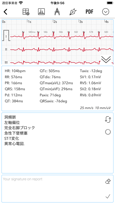 ECG for Doctorsスクリーンショット