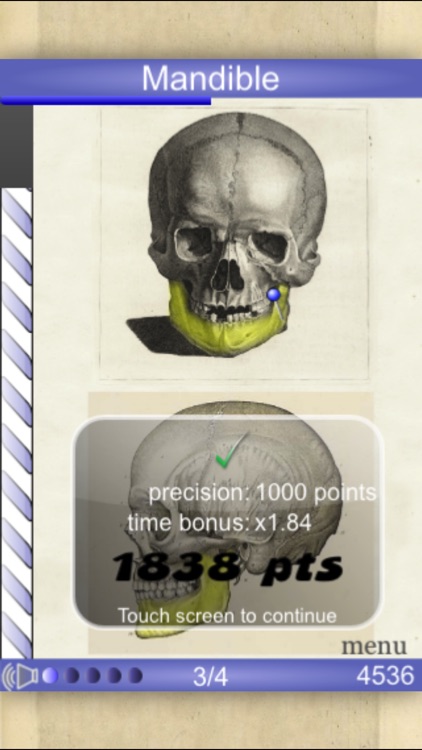 Speed Bones MD