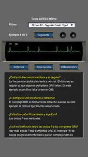 tutor del ecg ritmo problems & solutions and troubleshooting guide - 4