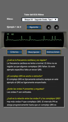 Game screenshot Tutor del ECG Ritmo apk