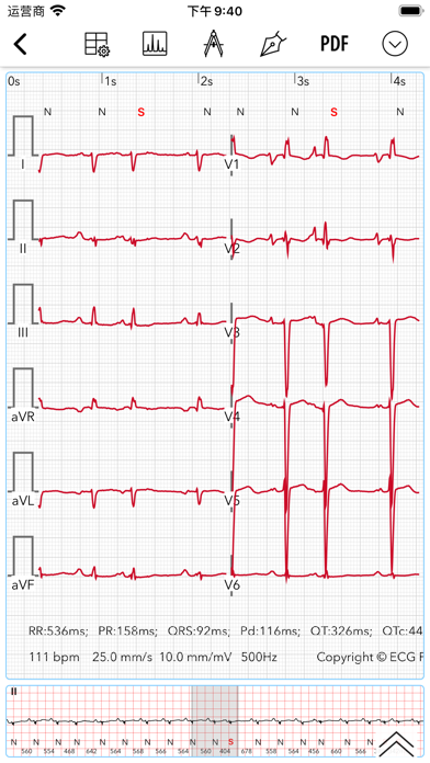 ECG Pro | 心电图精通之路 screenshot