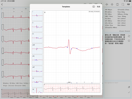 ECG Pro for Doctorsのおすすめ画像7