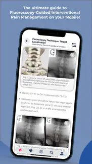 interventional pain app iphone screenshot 3
