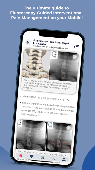 Screenshot #3 pour Interventional Pain App