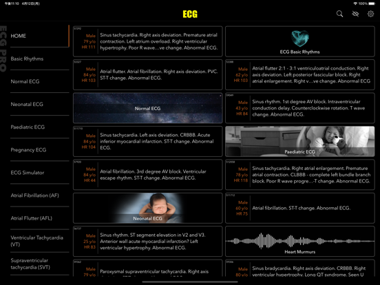 Screenshot #4 pour ECG Pro for Doctors
