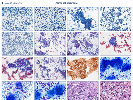 Johns Hopkins Atlas of Pancreatic Cytopathologyのおすすめ画像2