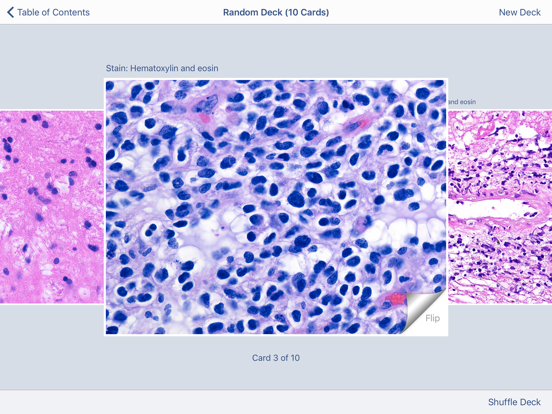 Johns Hopkins Atlas of Surgical Neuropathologyのおすすめ画像5