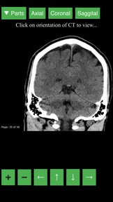Radiology CT Viewer screenshot