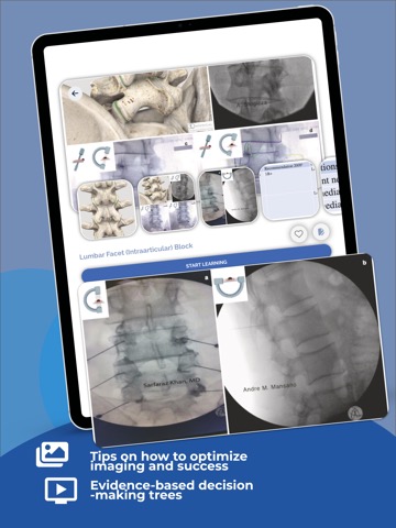 Interventional Pain Appのおすすめ画像3