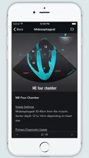 echo views - transesophageal echocardiography iphone screenshot 2