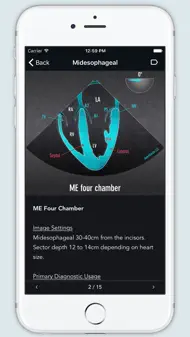 ECHO Views - Transesophageal Echocardiography iphone bilder 1
