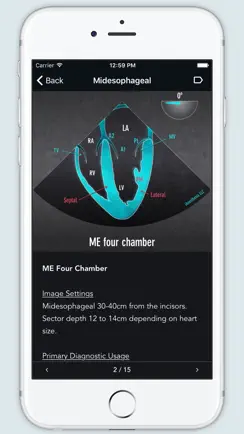 ECHO Views - Transesophageal Echocardiography iPhone image 2