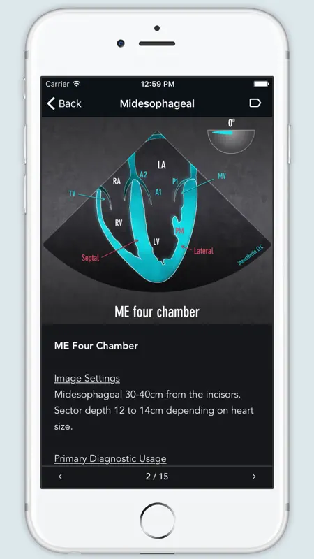 ECHO Views - Transesophageal Echocardiography screenshot 2 of 5