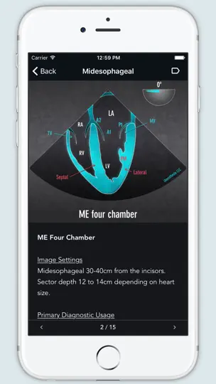 Capture d'écran de ECHO Views - Transesophageal Echocardiography sur iPhone 2