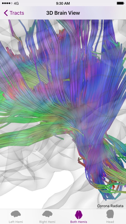 Brain Tutor 3D