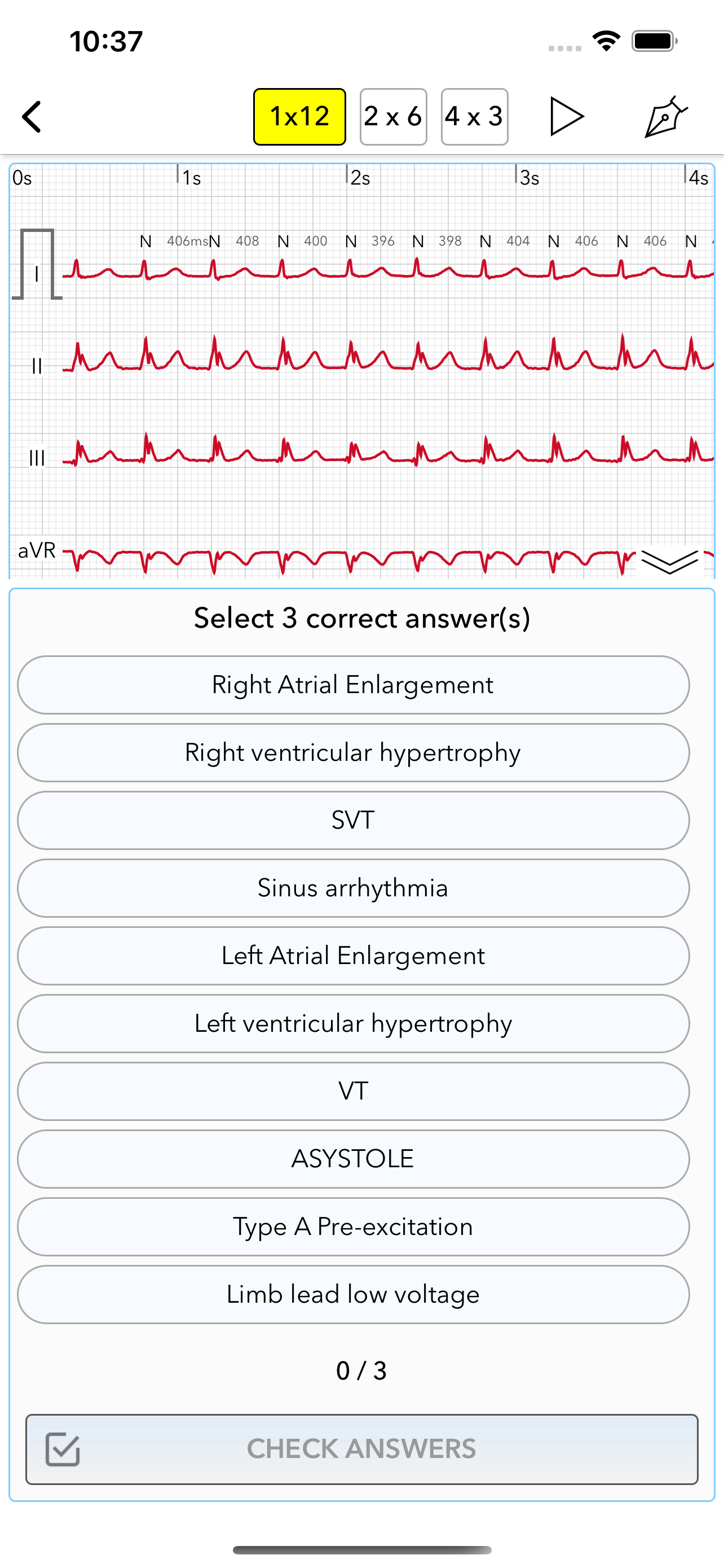 ECG Test for Doctors