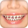 Braces Camera Photo Editor