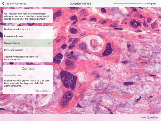 Johns Hopkins Atlas of Pancreatic Pathologyのおすすめ画像5