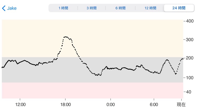 Dexcom Follow mg/dL DXCM10 screenshot-3