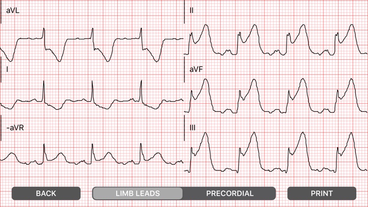 Medical Rescue Sim Pro screenshot-4