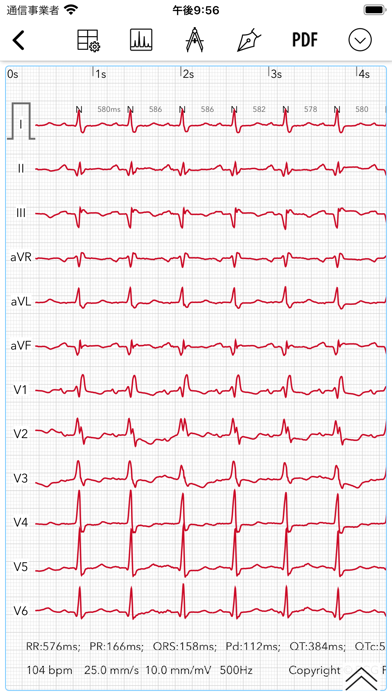 ECG Pro for Doctorsのおすすめ画像2