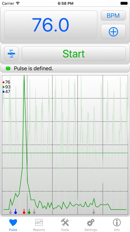 iHeart Pro - Pulse Reader