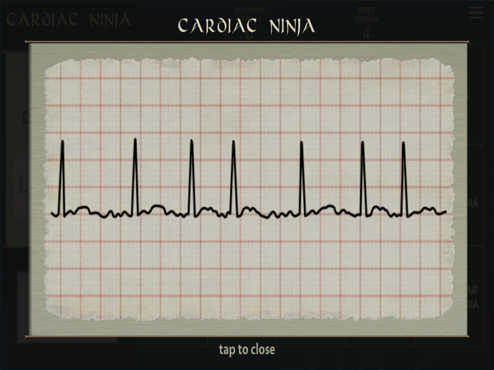 Cardiac Ninja