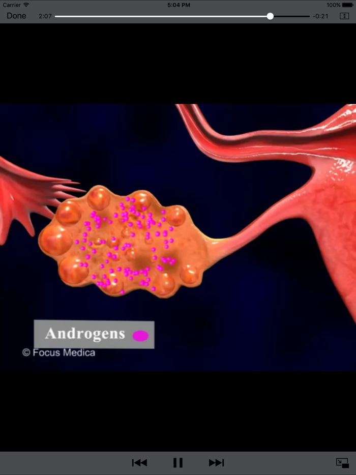 Gynaecology - Understanding Disease