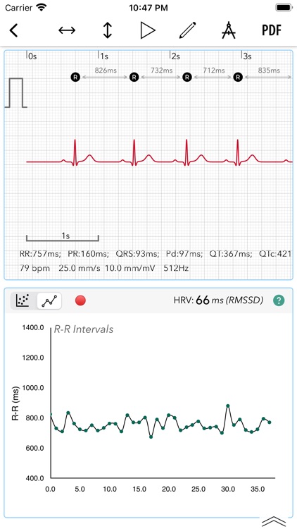 ECG+ | Analyzer for QTc & HRV screenshot-4