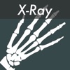 X-Ray Photo Effects - iPhoneアプリ