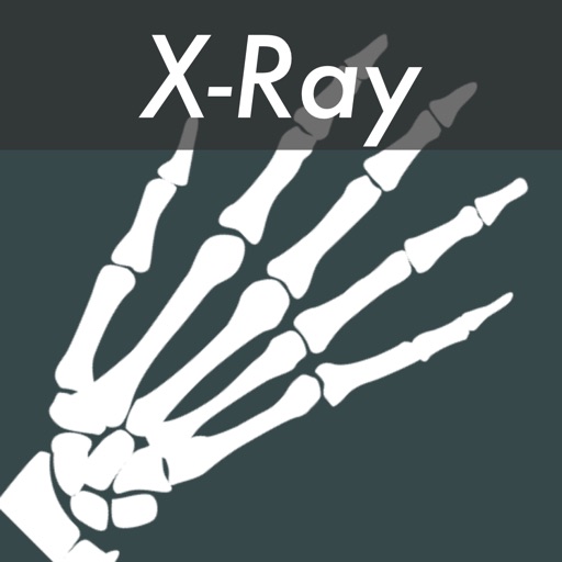 X-Ray Photo Effects