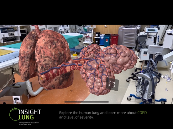 INSIGHT LUNG Screenshots