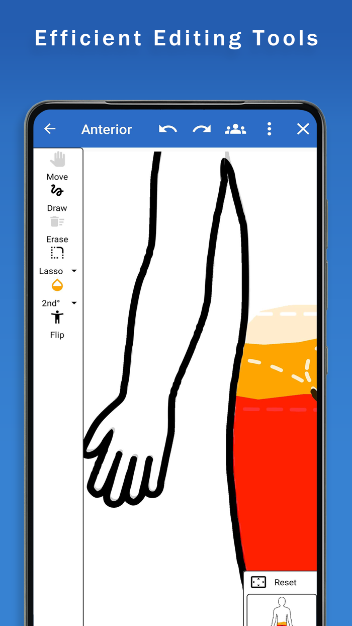 Surface Burn Calculator
