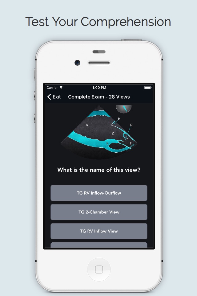 ECHO Views - Transesophageal Echocardiography screenshot 4