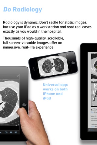Radiology - Thoracic Imaging screenshot 3