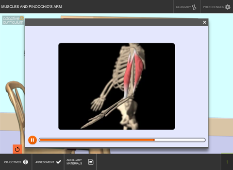 Muscles and Pinocchio’s Arm - náhled